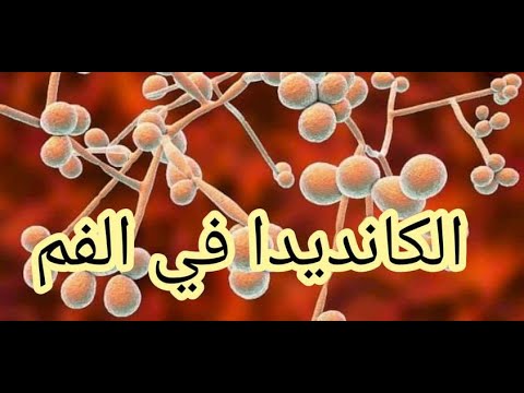 الكانديدا في الفم اغيثوا غزة أنقذوا غزة