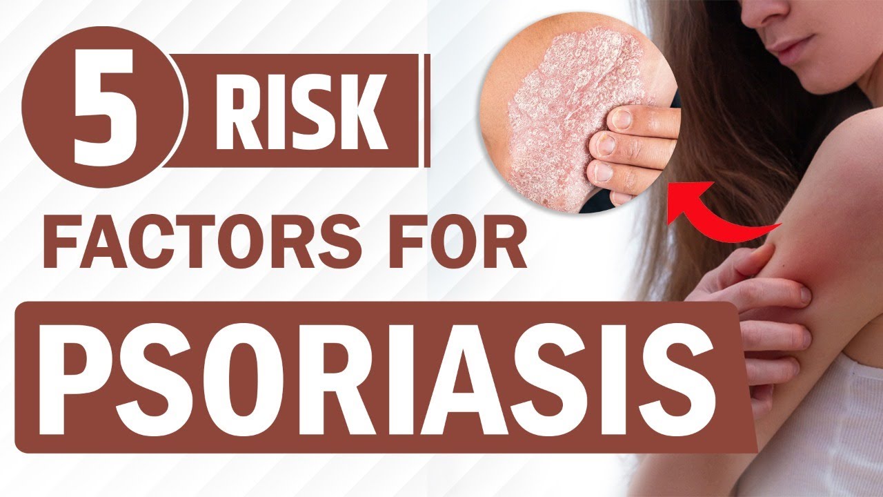 5 Risk factors for Psoriasis | Tips for Psoriasis recovery | Dr. Megha ...