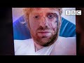 Shocking stories of disability hate crimes - BBC