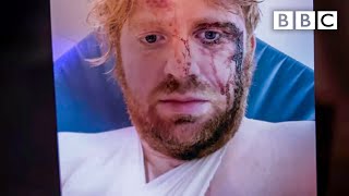 Shocking stories of disability hate crimes - BBC