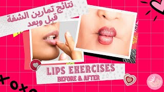 LIPS Exercises Results! Before and After pics | نتائج تمارين االشفة! صور قبل وبعد