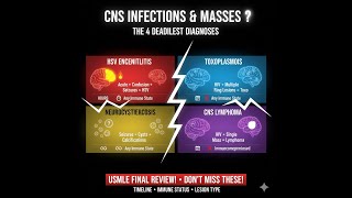 Stop Memorizing: A Systematic Roadmap to CNS Disorders - USMLE