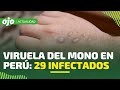 Viruela del mono en Perú: aumentan a 29 los infectados en doce distritos de Lima Metropolitana