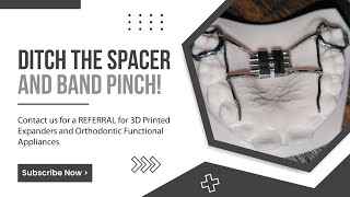 ODL Appliances and 3d Printed Expander