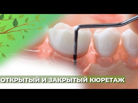 Открытый и закрытый кюретаж☘️
