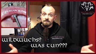 Wildfleisch Am Piercing? Was Tun? Alles Über Wildwuchs/Wildfleisch