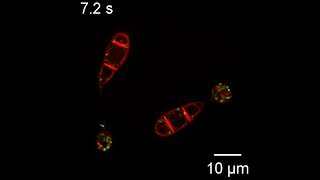 S8 Movie. Dynamics and mobility of MoVps29-GFP.
