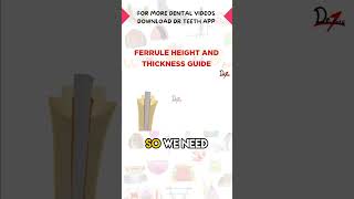 Ferrule Height And Thickness Guide