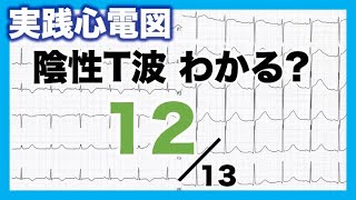 【心電図 読み方 ⑫】陰性T波 QT延長