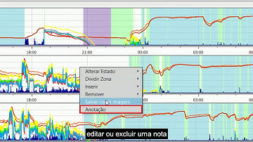 ActStudio Tutorial 10 - Menu de Ações da Pontuação do Sono
