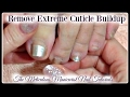 👣 Pedicure Tutorial: Cleaning Extreme Amount of Dead Cuticle Skin on Toenails Dry Cracked Calluses