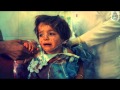 معاناة اطفال سوريا ( الصورة تتكلم )