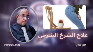 علاج الشرخ الشرجي