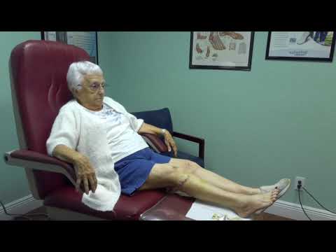Common Peroneal Nerve