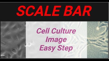 Set a Scale Bar using Fiji ImageJ - Easy Step-by-Step Tutorial