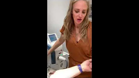 Lentigines/Sun Spot Treatment with IPL @CPW Vein &...