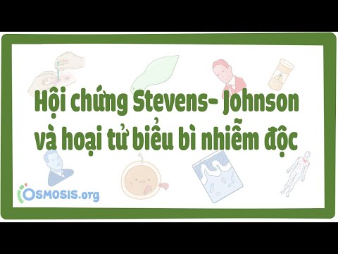 Hội chứng Stevens- Johnson và hoại tử biểu bì nhiễm độc