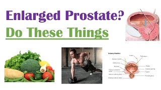 What to Do and Not Do with Enlarged Prostate | Lifestyle Modifications