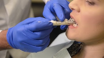 SOMGauge Bite Registration Video