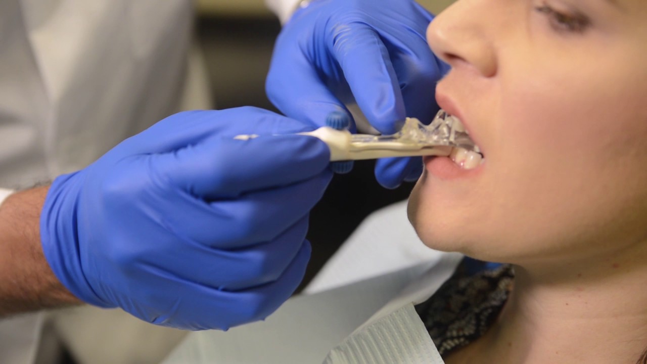 SOMGauge Bite Registration Video YouTube