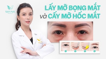 LẤY MỠ BỌNG MẮT VÀ CẤY MỠ HỐC MẮT NHƯ THẾ NÀO LÀ ĐẸP?