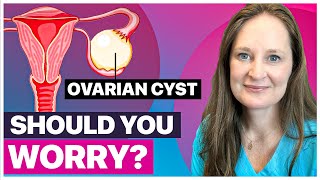 Ovarian Cysts: Everything You Need to Know by Dr. Lora Shahine