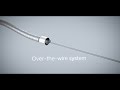 Cut, capture, clear - Philips Phoenix Atherectomy Mechanical System