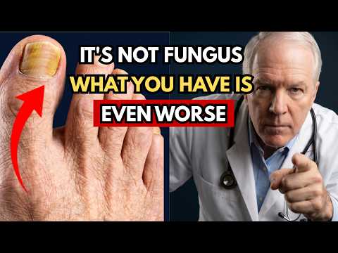 If Your 'Fungus' Has Lasted Years Without Improving, Here's What Your Body Is Really Telling You