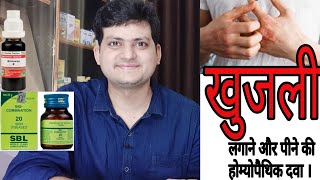 Best Homepathic medicine for itching in my clinic ? ep14 part 2 with skin external Combination | screenshot 5