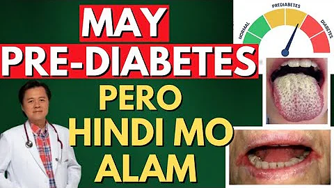 May PRE-DIABETES Pero Hindi Mo Alam. - By Doc Willie Ong (Internist and Cardiologist)