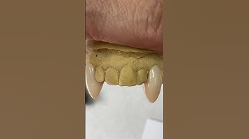 Custom acryGrip Partial with #Vampire #Fangs #dental #teeth #smile #lsk121shorts #shortvideo #shorts