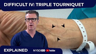 Difficult Intravenous Iv Cannulation Triple Tourniquet Technique