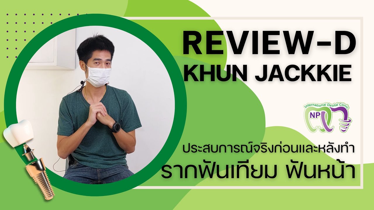 คุณแจ็คกี้มารีวิวการทำ รากฟันเทียม ดิจิตอล ฟันหน้า ที่ NP_IDC | Review-D EP.02