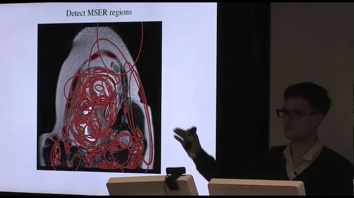 Kevin Keraudren: Localising organs of the fetus in...