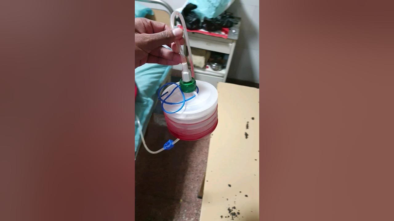 Close Wound Drainage System Romovac (shown in this video) tcml YouTube