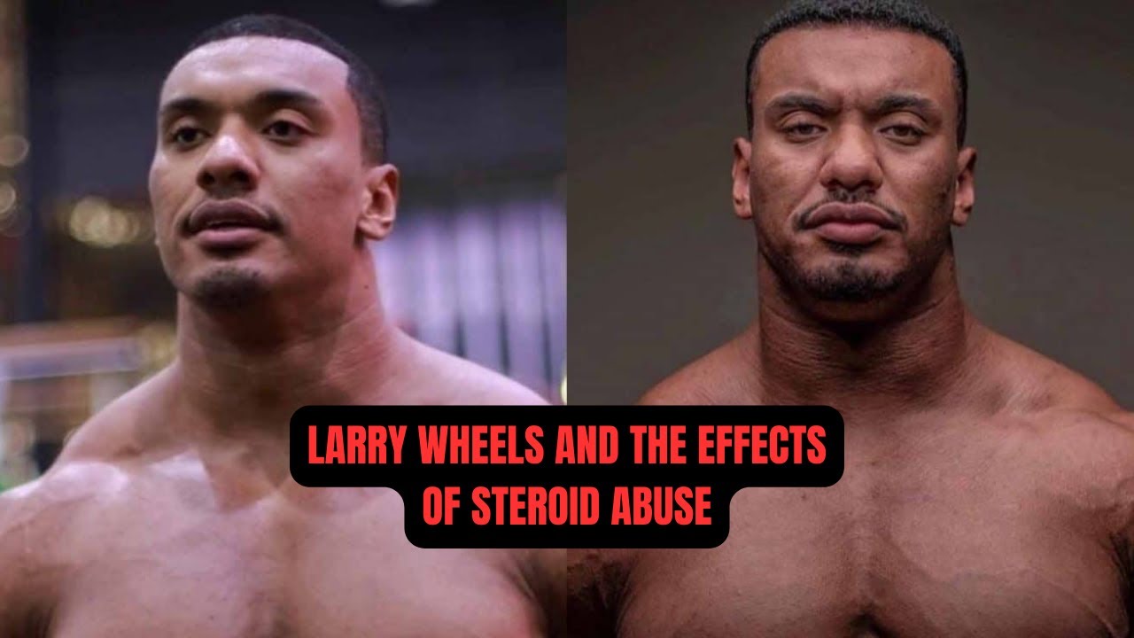 Larry Wheels' Shocking Transformation: Effects of Peak Steroid Abuse ...