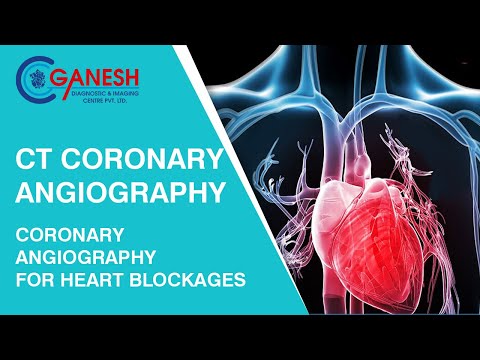 CT Coronary Angiography | Coronary Angiography for Heart Blockages | Ganesh Diagnostic