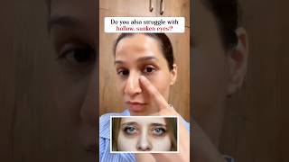 𝗧𝗶𝗿𝗲𝗱 𝗼𝗳 𝗵𝗼𝗹𝗹𝗼𝘄 𝗮𝗻𝗱 𝘀𝘂𝗻𝗸𝗲𝗻 𝘂𝗻𝗱𝗲𝗿 𝗲𝘆𝗲𝘀?#FaceYoga #SunkenEyes #HollowEyes #darkcircles