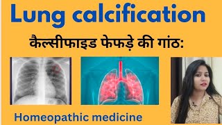 Lung calcification treatment !! Calcified granuloma symptoms,causes &amp; Homeopathic medicine in hindi