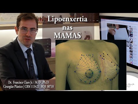 Vídeo: Como obter seios maiores sem cirurgia (com fotos)