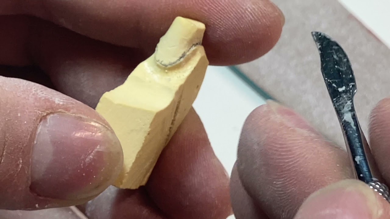 Bisellatura moncone per protesi fissa