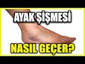 Ayak Şişmesine Ne iyi Gelir? Ayak Şişmesi Neden Olur?