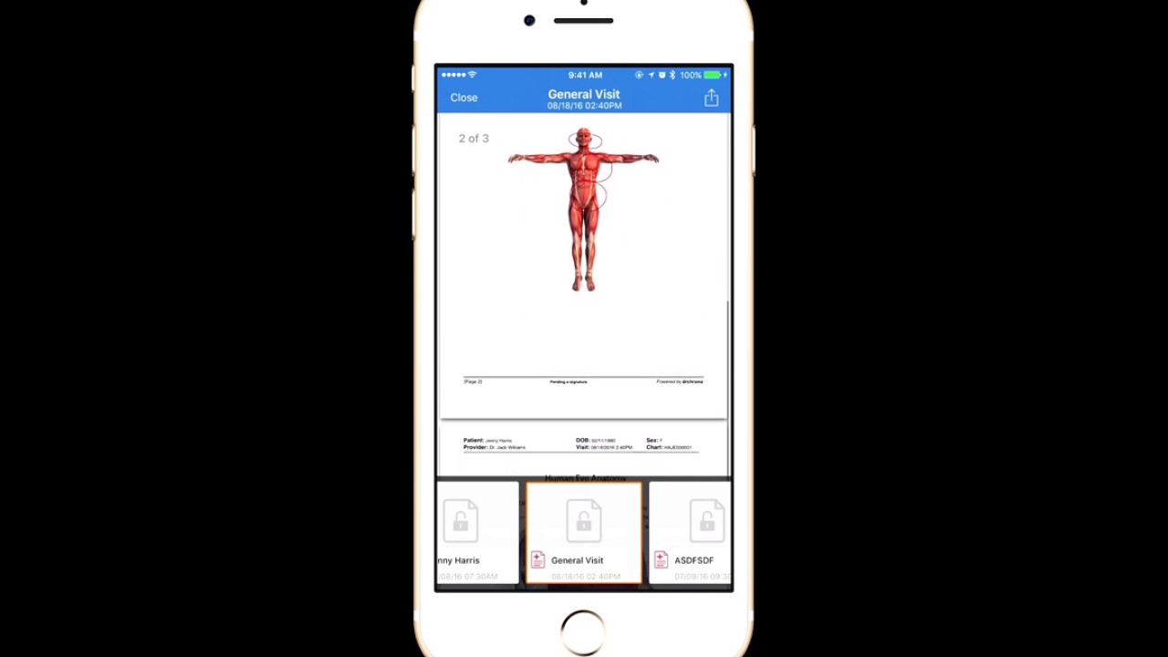 How to Share a medical record through iPhone EHR