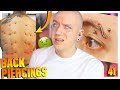 Reacting To Worst Surface Piercing Fails! | Piercing Gone Wrong 41 | Roly Reacts