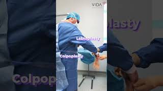 Female intimate #rejuvenation 🤭 with our #gynecologist Dr.Saldaña 👨🏻‍⚕️✨ #doctor #gynecologist ✨ screenshot 4