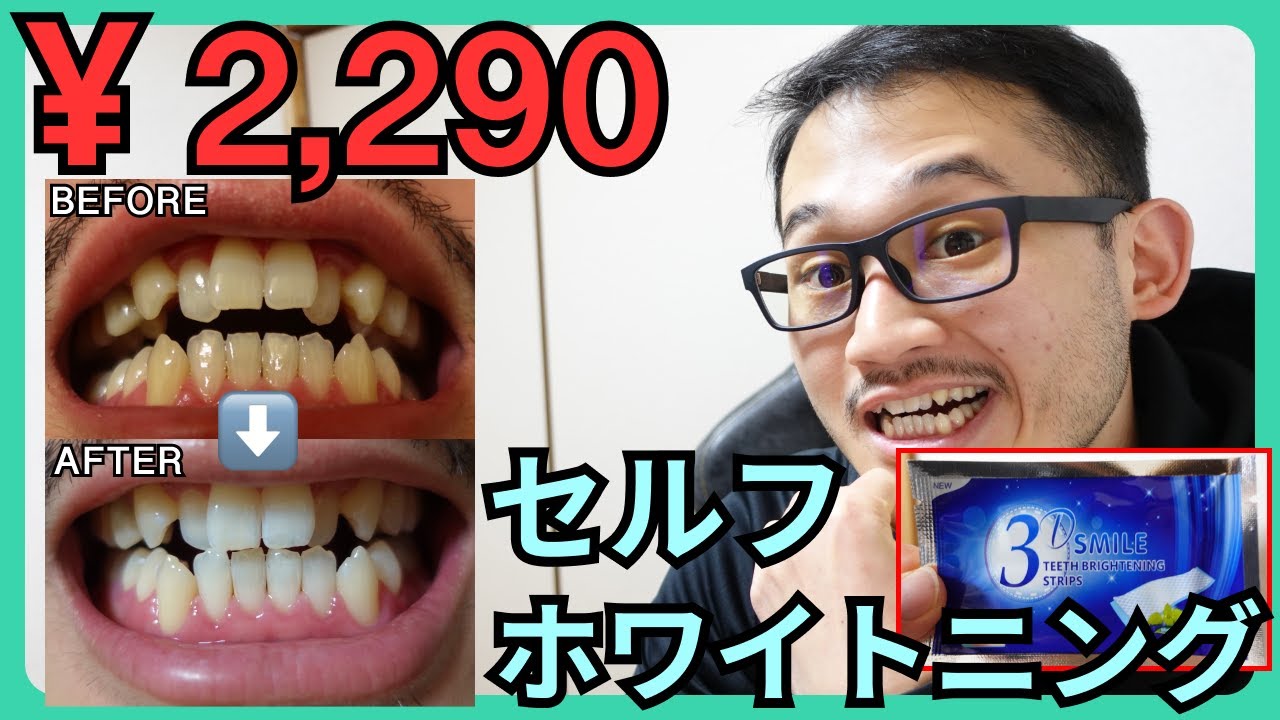 2,290 yen] Whiten your teeth with whitening sheets [If they're not