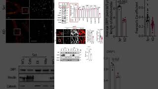 JCS snapshot - the ER protein FAM134B acts as a regulator of mitochondrial morphology