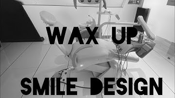 DENTISTRY— SMILE DESIGN & WAX-UP