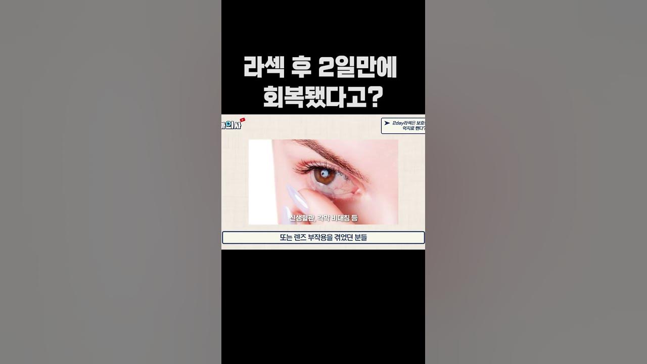 라섹 후 회복 빠른사람 Vs 느린사람 차이 - Youtube