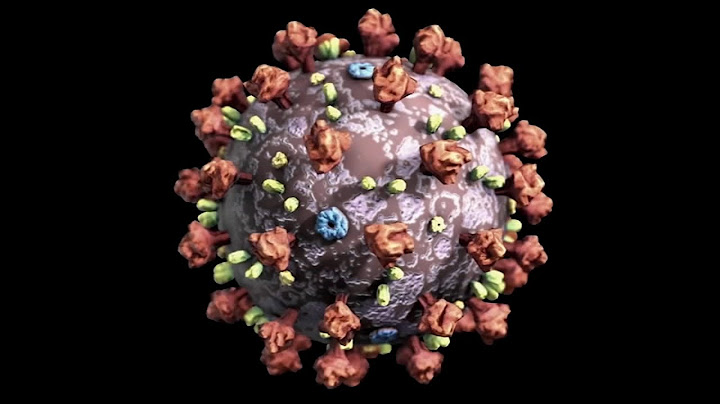 COVID-19 cases on the rise in Bay Area; highest levels since winter, health officials say